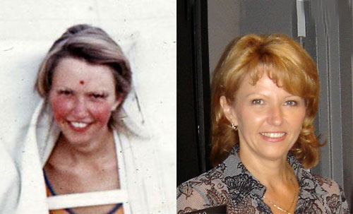 Вия Слактере